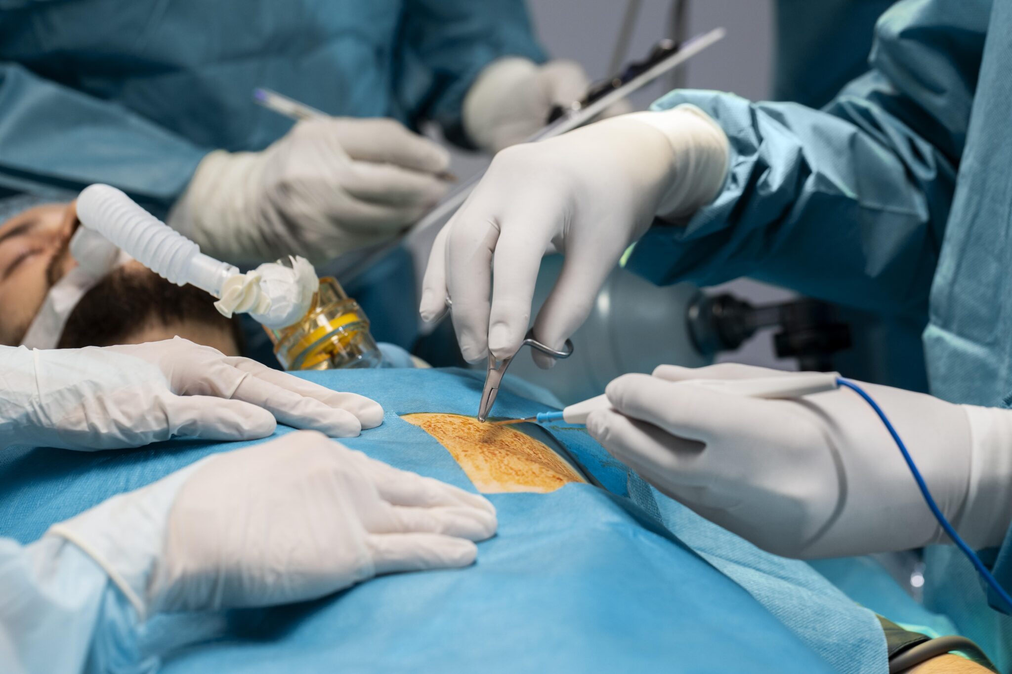doctors-doing-surgical-procedure-patient-2048x1365